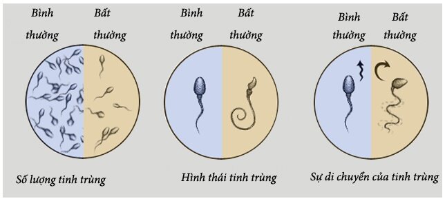 tinh trùng thấp