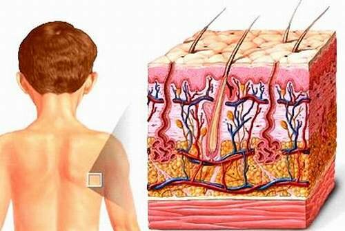 Tổn thương da atopy