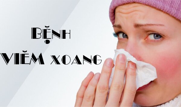 bệnh viêm xoang